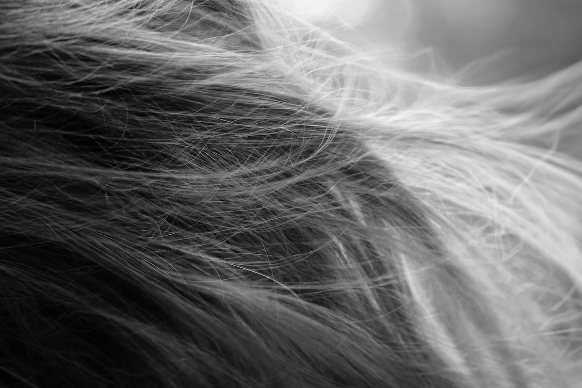 Hair loss treatment in Malaysia